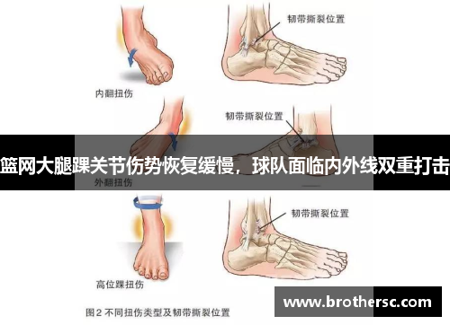 篮网大腿踝关节伤势恢复缓慢，球队面临内外线双重打击